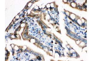 Anti- Plectin Picoband antibody, IHC(P) IHC(P): Rat Intestine Tissue (PLEC antibody  (Middle Region))