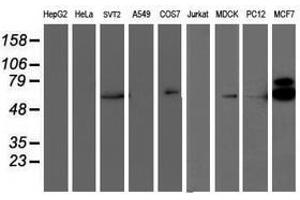 Image no. 3 for anti-Ribosomal Protein S6 Kinase, 70kDa, Polypeptide 1 (RPS6KB1) antibody (ABIN1500001)