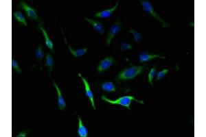 Immunofluorescent analysis of Hela cells using ABIN7151506 at dilution of 1:100 and Alexa Fluor 488-congugated AffiniPure Goat Anti-Rabbit IgG(H+L) (SLC4A8 antibody  (AA 1-300))