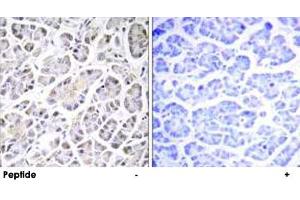 Immunohistochemistry analysis of paraffin-embedded human pancreas tissue using ATP5G3 polyclonal antibody .