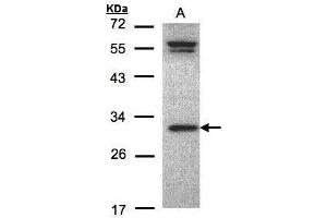 WB Image Sample(30 ug whole cell lysate) A:MOLT4 , 12% SDS PAGE antibody diluted at 1:1000