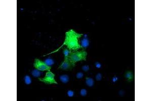 Anti-EPN2 mouse monoclonal antibody (ABIN2455557) immunofluorescent staining of COS7 cells transiently transfected by pCMV6-ENTRY EPN2 (RC213652). (Epsin 2 antibody)