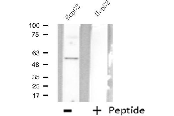 AGXT2L2 antibody  (C-Term)