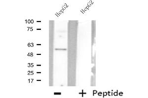 Western blot analysis of extracts from HepG2 cells using AGXT2L2 antibody. (AGXT2L2 antibody  (C-Term))