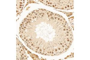 Immunohistochemistry of paraffin embedded rat testis using DNApoldelta3 (ABIN7075130) at dilution of 1:1000 (300x lens)