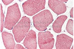 Immunohistochemistry (IHC) image for anti-Nuclear Respiratory Factor 1 (NRF1) (N-Term) antibody (ABIN2780635)