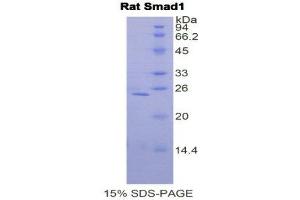 SDS-PAGE (SDS) image for SMAD, Mothers Against DPP Homolog 1 (SMAD1) (AA 273-468) protein (His tag) (ABIN1080318) (SMAD1 Protein (AA 273-468) (His tag))