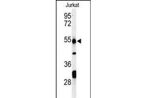Western blot analysis of PRUNE Antibody (C-term) (ABIN653704 and ABIN2843021) in Jurkat cell line lysates (35 μg/lane). (PRUNE antibody  (C-Term))