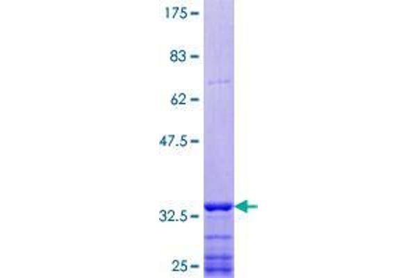SEMA6D Protein (AA 852-940) (GST tag)