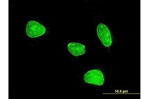 Immunofluorescence of monoclonal antibody to MEF2BNB on HeLa cell . (MEF2BNB antibody  (AA 1-109))
