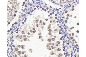 Immunohistochemistry analysis of paraffin-embedded rat testis using HES2 Polyclonal Antibody at dilution of 1:200. (HES2 antibody)