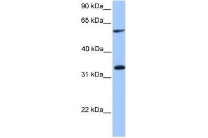 TSKS antibody used at 1 ug/ml to detect target protein. (TSKS antibody  (Middle Region))