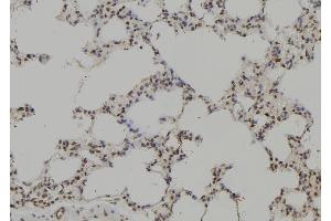 ABIN6269204 at 1/100 staining Rat lung tissue by IHC-P. (SHP1 antibody  (C-Term))