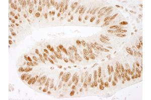 Immunohistochemistry (IHC) image for anti-Zinc Finger Protein 326 (ZNF326) (AA 532-582) antibody (ABIN7449042)