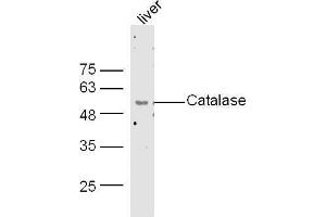 Mouse liver lysates probed with Rabbit Anti-Catalase Polyclonal Antibody, Unconjugated  at 1:500 for 90 min at 37˚C. (Catalase antibody  (AA 251-350))