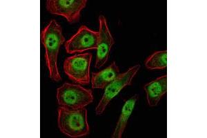Immunofluorescence analysis of NTERA-2 cells using JMJD2A monoclonal antibody, clone 5H1  (green) .