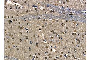 ABIN6263498 and ABIN6268752 at 1/100 staining rat brain tissue by IHC-P. (MYCN antibody  (Internal Region))