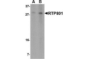 Western Blotting (WB) image for anti-DNA-Damage-Inducible Transcript 4 (DDIT4) (N-Term) antibody (ABIN1031547) (DDIT4 antibody  (N-Term))
