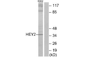 Western blot analysis of extracts from K562 cells, using HEY2 antibody.