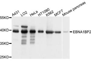 Western blot analysis of extracts of various cell lines, using EBNA1BP2 antibody. (EBNA1BP2 antibody)