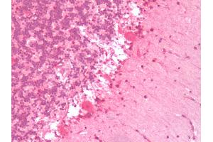 Human Brain, Cerebellum: Formalin-Fixed, Paraffin-Embedded (FFPE) (Serotonin Receptor 6 antibody  (C-Term))