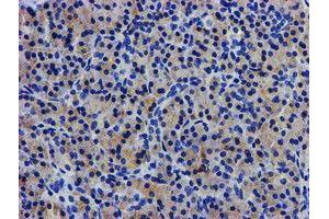 Immunohistochemistry (IHC) image for anti-Lipoprotein Lipase (LPL) (AA 28-475) antibody (ABIN1491320)