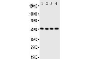 Anti-Glucose Transporter 5 GLUT5 antibody, Western blotting Lane 1: U87 Cell Lysate Lane 2: 293T Cell Lysate Lane 3:  Cell Lysate Lane 4: SW620 Cell Lysate (SLC2A5 antibody  (C-Term))