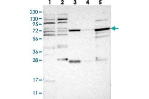 Western blot analysis of Lane 1: RT-4, Lane 2: U-251 MG, Lane 3: Human Plasma, Lane 4: Liver, Lane 5: Tonsil with NUDCD1 polyclonal antibody  at 1:250-1:500 dilution. (NUDCD1 antibody)