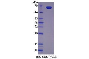 SDS-PAGE (SDS) image for Secernin 1 (SCRN1) (AA 2-414) protein (His tag) (ABIN4989574)