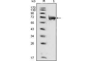 Western blot analysis using FGFR1 mouse mAb against extracellular domain of human FGFR1 (aa22-376). (FGFR1 antibody  (AA 22-376))