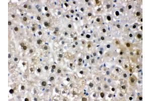 Immunohistochemistry (IHC) image for anti-Damage Specific DNA Binding Protein 1 (DDB1) (AA 1011-1140) antibody (ABIN3043823)
