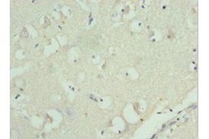 Immunohistochemistry of paraffin-embedded human brain tissue using ABIN7142845 at dilution of 1:100 (RPL9 antibody  (AA 1-192))