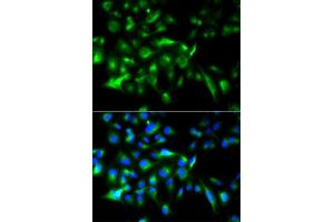 Immunofluorescence analysis of HeLa cell using MYD88 antibody. (MYD88 antibody  (AA 60-309))