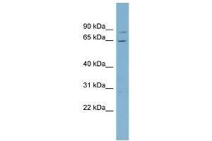 WB Suggested Anti-RPA1  Antibody Titration: 0. (RPA1 antibody  (Middle Region))