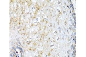 Immunohistochemistry of paraffin-embedded Human esophagus using NMU Polyclonal Antibody at dilution of 1:100 (40x lens). (Neuromedin U antibody)