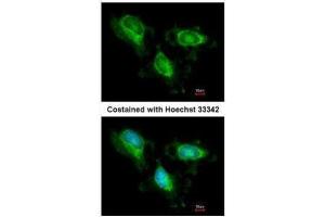ICC/IF Image Immunofluorescence analysis of methanol-fixed HeLa, using Fumarate hydratase, antibody at 1:200 dilution. (FH antibody)