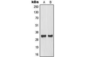 Western blot analysis of TCFL4 expression in LOVO (A), mouse placenta (B) whole cell lysates. (MLX antibody  (Center))