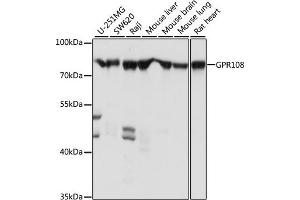 Western blot analysis of extracts of various cell lines, using GPR108 antibody (ABIN7267291) at 1:1000 dilution. (GPR108 antibody  (AA 33-260))