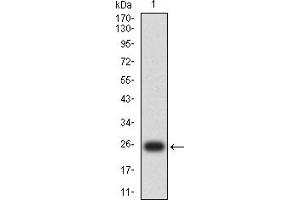 Western blot analysis using MLH1 mAb against human MLH1 (AA: 381-483) recombinant protein. (MLH1 antibody  (AA 381-483))