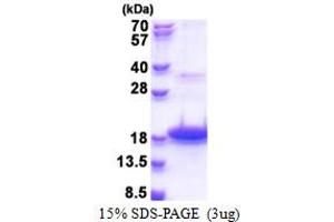 SDS-PAGE (SDS) image for Defensin, beta 118 (DEFB118) (AA 21-123) protein (His tag) (ABIN5778673) (DEFB118 Protein (AA 21-123) (His tag))