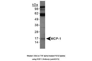 Image no. 1 for anti-Chemokine (C-C Motif) Ligand 2 (CCL2) (AA 15-40) antibody (ABIN363682) (CCL2 antibody  (AA 15-40))