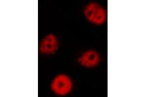 ABIN6269187 staining Hela by IF/ICC. (EIF2AK2 antibody  (Internal Region))