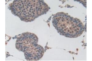 Detection of Plg in Rat Testis Tissue using Polyclonal Antibody to Plasminogen (Plg) (PLG antibody  (AA 191-433))