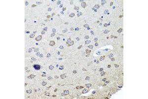 Immunohistochemistry of paraffin-embedded mouse brain using CHRNB2 antibody at dilution of 1:100 (x40 lens). (CHRNB2 antibody)