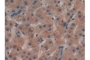 Immunohistochemistry (IHC) image for anti-Plexin B1 (PLXNB1) (AA 200-727) antibody (ABIN7438175)
