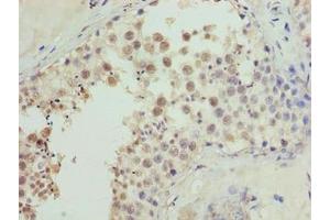 Immunohistochemistry of paraffin-embedded human testis tissue using ABIN7149078 at dilution of 1:100 (CDADC1 antibody  (AA 1-99))