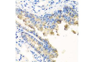 Immunohistochemistry of paraffin-embedded mouse lung using NYX antibody at dilution of 1:100 (40x lens). (Nyctalopin antibody)