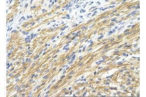 Rabbit Anti-MBNL1 Antibody       Paraffin Embedded Tissue:  Human cardiac cell   Cellular Data:  Epithelial cells of renal tubule  Antibody Concentration:   4. (MBNL1 antibody  (Middle Region))