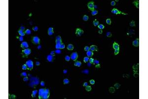 Immunofluorescence staining of 293 cells with ABIN7171036 at 1:100, counter-stained with DAPI. (SUSD5 antibody  (AA 46-287))