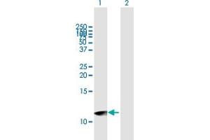 Western Blot analysis of UTS2D expression in transfected 293T cell line by UTS2D MaxPab polyclonal antibody. (Urotensin 2B antibody  (AA 1-119))